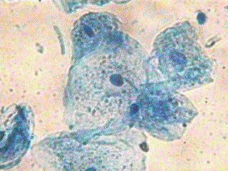 cellen van wangslijmvlies (gekleurd met eosine)